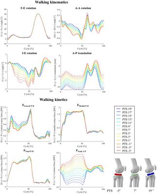Posterior tibial slope influences joint mechanics and soft tissue loading after total knee arthroplasty